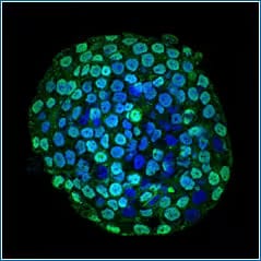 Immunocytochemistry image of CENPA antibody expression in colon cancer cells