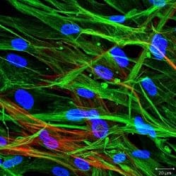 Immunocytochemistry image of Cardiac Fibroblasts