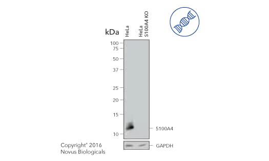 Western blot of S100A4 expression