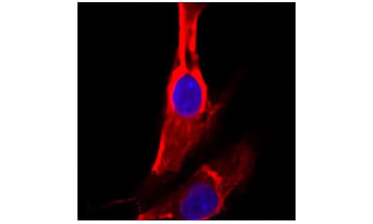 Immunocytochemistry image of P4HB expression in HeLa cell line.