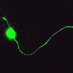 Detection of mature retinal ganglion cell demonstrating axon outgrowth by ICC using Sheep Polyclonal GAP-43 antibody 