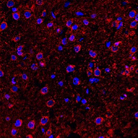 Immunofluorescent image of 5-HT6 antibody expression in rat brain tissues.