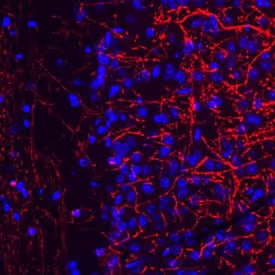 Immunofluorescent image of mouse brain cryosections.