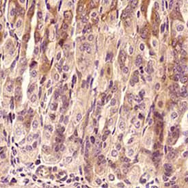 Immunohistochemical expression of TNF-alpha antibody in mouse intestine tissue.