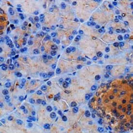 Immunohistochemical analysis of Somatostatin Receptor 2 antibody expression.