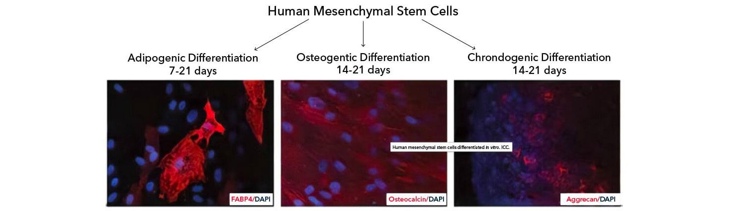 Human Mesenchymal Stem Cell Differentiation