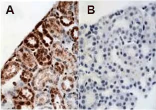 Immunohistochemistry analysis of HIF-1 alpha expression in mouse kidney tissue