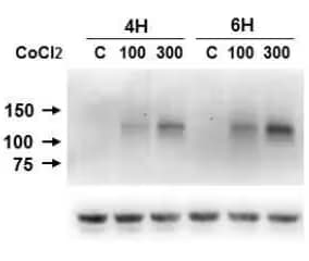 Western blot of HIF-1 alpha antibody expression in Caki-1 cell lysates