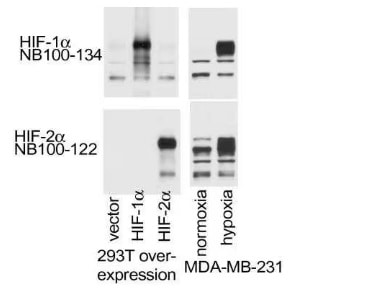 Western blot of HIF-2 alpha antibody expression in MDA-MB-231 cell lysates
