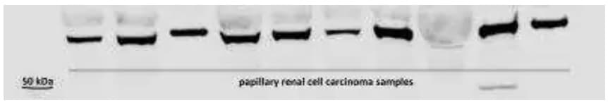 Western blot of HIF-3 alpha antibody expression in human papillary renal cell carcinoma