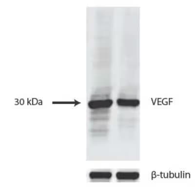 Western blot of VEGF antibody expression