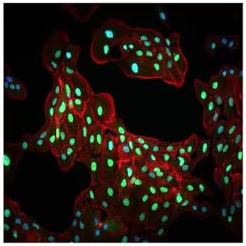 Immunocytochemistry analysis of HIF-1 alpha expression in ARPE-19 cells under hypoxic conditions