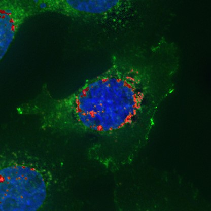 Co-detection of EGFR protein and RNA by ICC and RNAscope