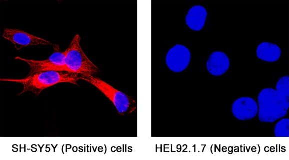 Detection of neuron-specific beta-III tubulin in SH-SY5Y cells by ICC