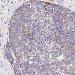 VEGFR1/Flt-1 Expression