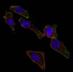Confocal immunofluorescent analysis