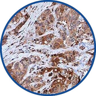 Figure 5: c-Myc antibody immunohistochemistry paraffin