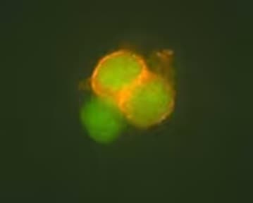Fluorescent imaging of CD4 expression in human T cells
