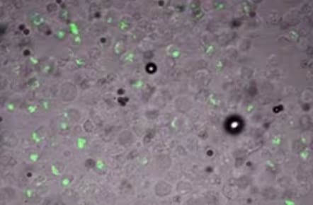 Immunocytochemistry image of Perforin expression in CD8 T-cells