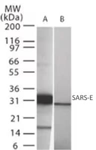 Western blot of SARS-E expression