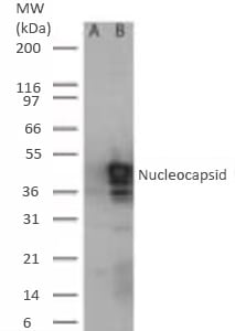 Western blot of SARS Nucleocapsid expression in transfected and untransfected mouse melanoma cell lysate