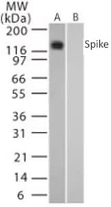 Western blot of SARS spike protein in transfected and untransfected mouse melanoma cell lysate