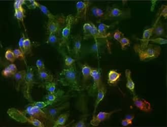 Immunocytochemistry image of CD11b expression in RAW264.7 cells
