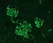Fluorescent Immunohistochemistry image of Complement C3 expression in mouse kidney