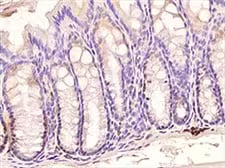 IHC image of TLR3 expression in mouse colon
