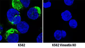 Immunocytochemistry expression of Vimentin in K562 and K562 Vimentin KO cells.