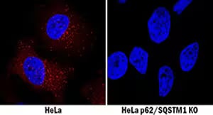 Immunocytochemistry image of p62/SQSTM1 expression in HeLa and HeLa p62/SQSTM1 KO cells.