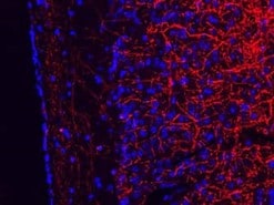 IHC image of mouse brain slice showing staining for MBP