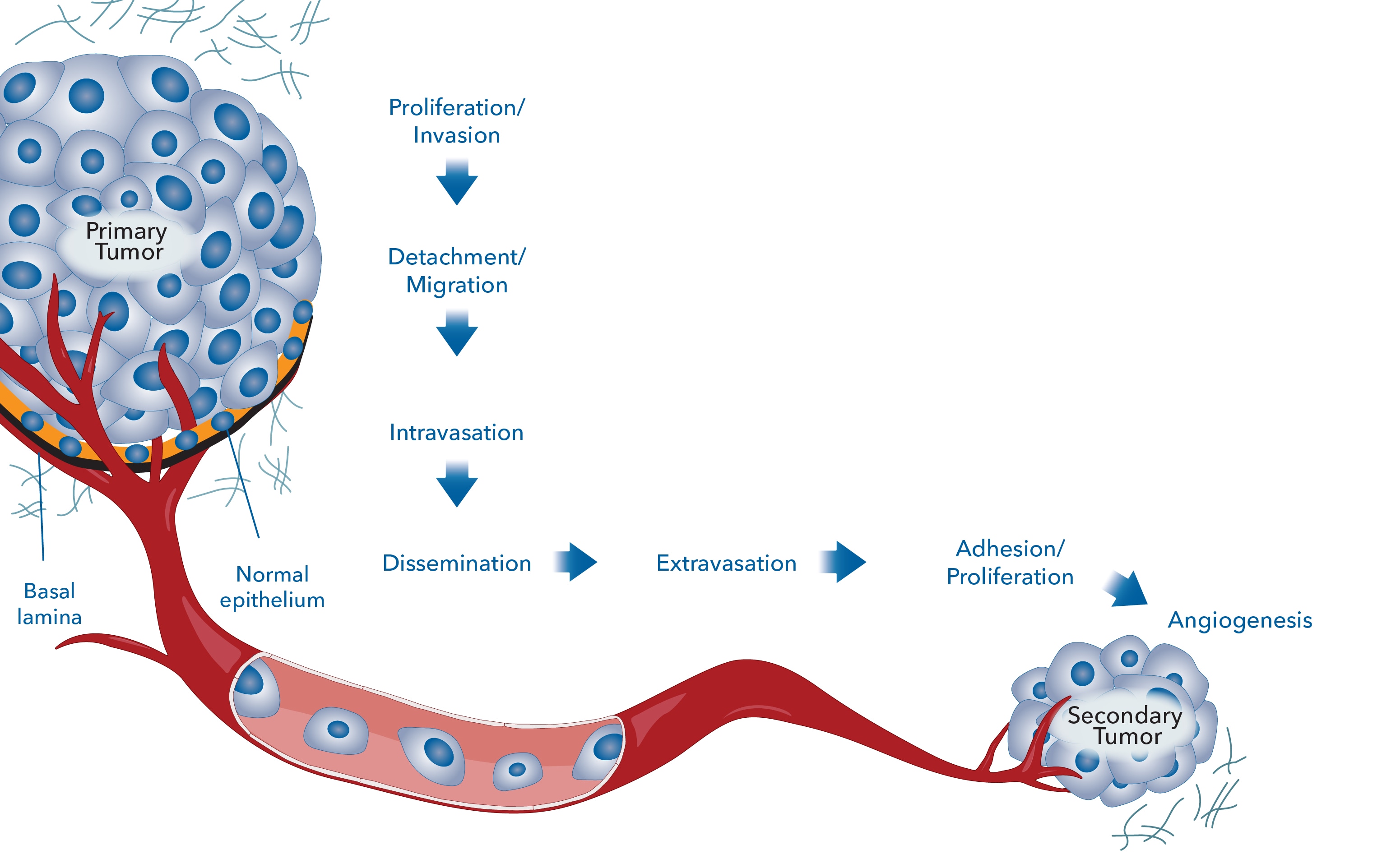 Metastasis Cascade and Mechanisms of Suppression
