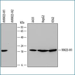 Western blot expression of NM23-H1 antibody in various human epithelial carcinoma cell line lysates