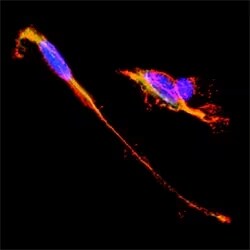 Detection of NCAM in neuroblastoma cells by ICC using Goat Anti-Human/Mouse NCAM-1/CD56 Polyclonal Antibody 