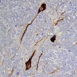 Immunohistochemical detection of tyrosine hydroxylase antibody in human brain tissue.