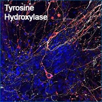 Tyrosine Hydroxylase staining in mouse embryonic stem cell-derived dopaminergic neurons