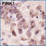 IHC staining of PINK1 in mouse brain