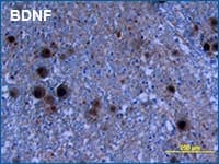 IHC staining of BDNF in human spinal cord
