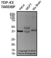 Western blot showing TDP-43/TARDBP in HeLa and MCF7 cells and mouse brain