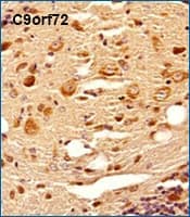 IHC staining of C9orf72 in mouse brain tissue