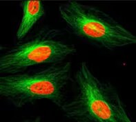 Tubulin (DM1A) [NB100-690]