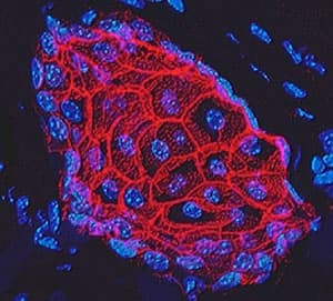 Immunofluorescent image of E-Cadherin expression