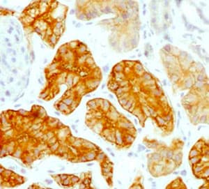 Immunohistochemical analysis of CD98 expression 