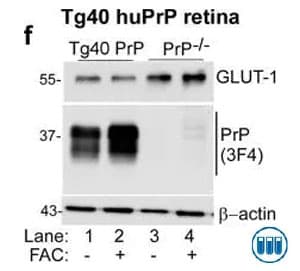 Western blot analysis showing the effect of iron overloading