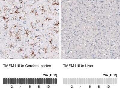 Comparison of TMEM119 antibody staining in human cerebral cortex and liver