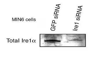 Western blot of IRE1-alpha expression in Min6 cell lysates transfected with GFP- or IRE1-siRNA