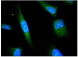 Immunochemistry/Immunofluorescence image of ATF6 expression in HeLa cells