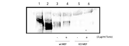 Western blot of PERK expression in various cell lines