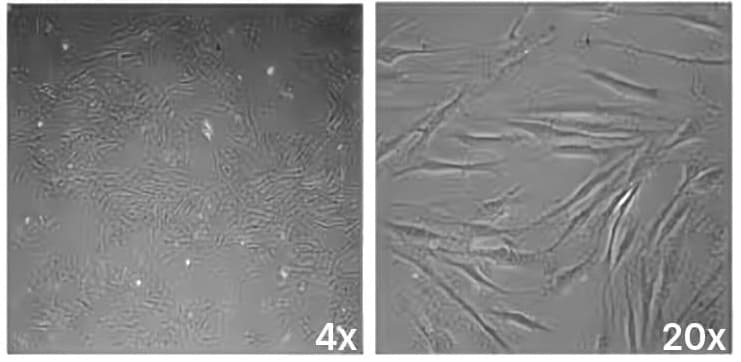 Bright-field image of Fibroblast Morphology